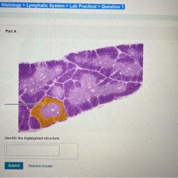 Pal histology lymphatic system lab practical question 1