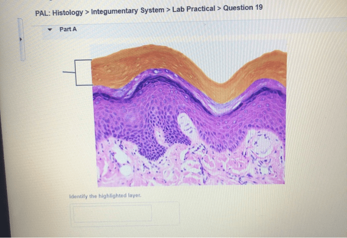 Pal histology lymphatic system lab practical question 1