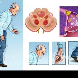 Alzheimer inhibitory interneuron gabaergic deficit cognitive neuroscience frontiers deficits implications involves