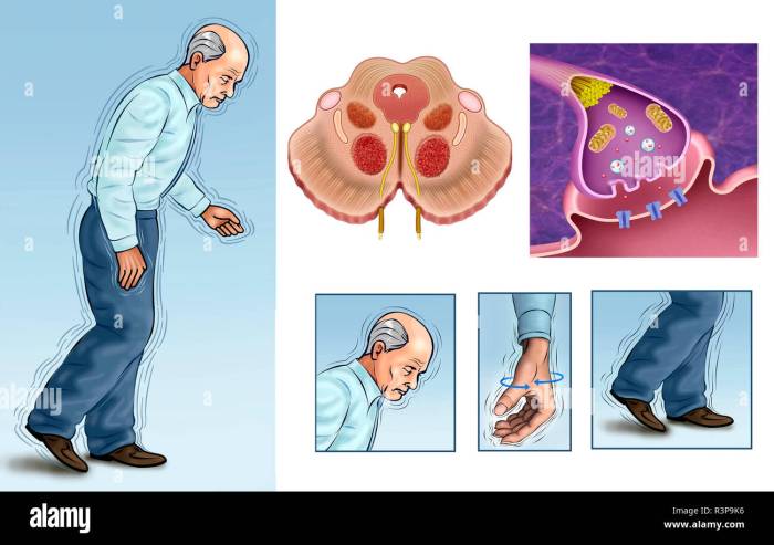 Alzheimer inhibitory interneuron gabaergic deficit cognitive neuroscience frontiers deficits implications involves